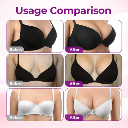 💥Virexo™ 💥Targeted Breast Enhancement Advanced Nano Microneedle Patch💥💥💥