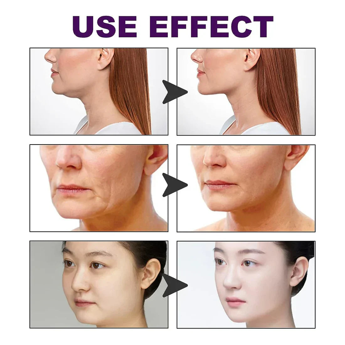 Cinta Lifting Iinvisible | Rejuvenece Tu Rostro 4x1